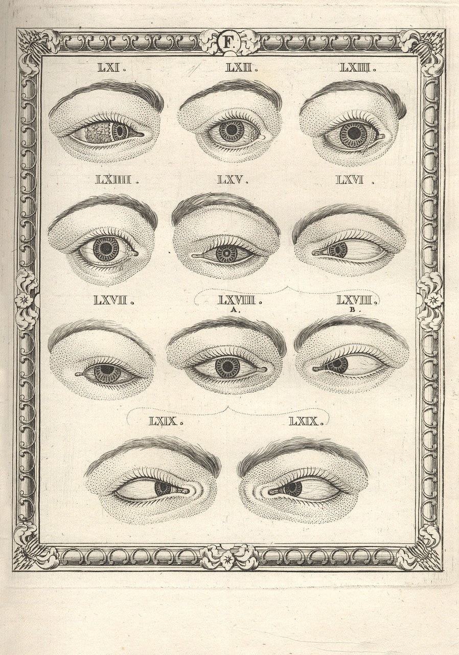 Tavola tratta da “Nova Nosographia Ophthalmica”, 1776, di John Taylor (1703-1772)