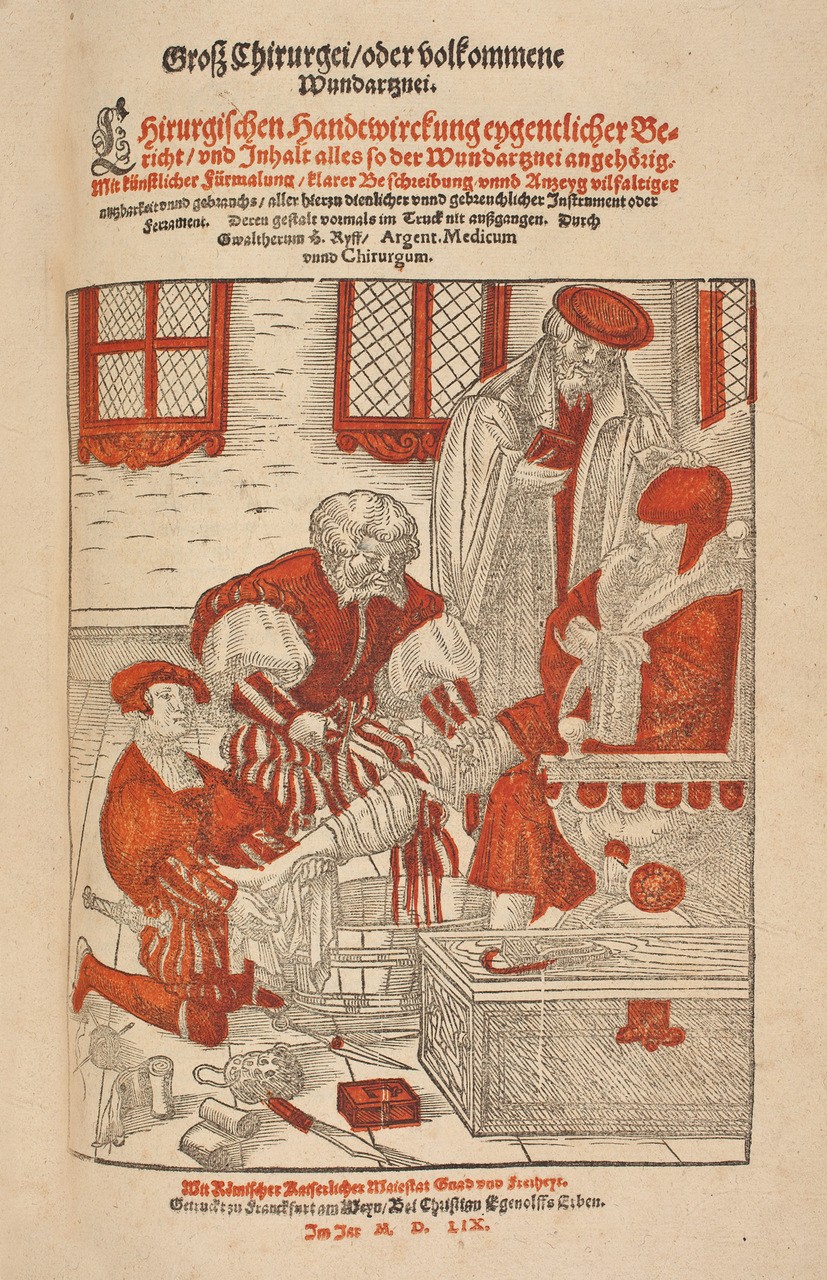Amputazione di una gamba. Tavola tratta dal libro “Grosz Chirurgei”, di Walter Ryff, 1559